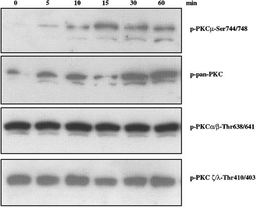 Figure 3. Effect of IGF-I on phosphorylation of PKC family members in H929 cells. H929 cells starved for 12 hours in serum-free medium were not stimulated or stimulated with 100 ng/mL IGF-I for varying times. Cell lysates were subjected to SDS-PAGE, transferred to membranes, and blotted with indicated antibodies.
