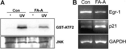 Figure 6. UV-mediated activation of JNK and expression of Egr-1 in FA-A primary leukocytes. (A) Peripheral blood mononuclear cells from a healthy donor (Con) and a patient with FA-A were exposed to UV radiation, and then cell lysates were immunoprecipitated with anti-JNK and subjected to immune complex kinase assay with GST-ATF2 as substrate (top panel). The lysates were analyzed by Western blot with anti-JNK (bottom panel). (B) Total RNA from UV-treated cells was extracted and analyzed for the expression of Egr-1 mRNA by semiquantitative RT-PCR. The levels of p21 were also analyzed. GAPDH mRNA was used as an amplification control.