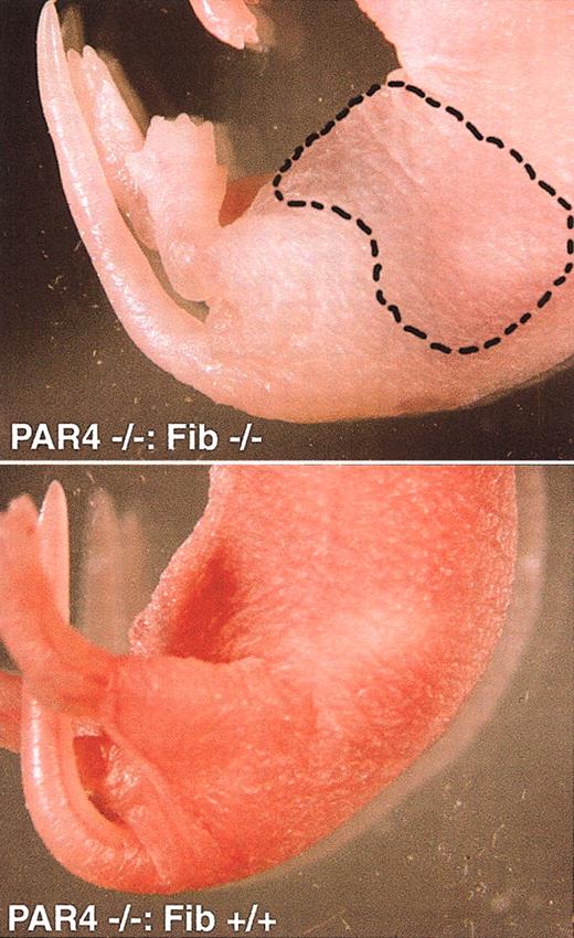 Figure 1. Affected and unaffected pups. Intraperitoneal bleed in a PAR4–/–: Fib–/– neonate (top). Note general pallor compared with a PAR4–/–: Fib+/+ littermate (bottom) as well as discoloration of the abdomen (hatched line). Autopsy confirmed the presence of blood in the peritoneal cavity.