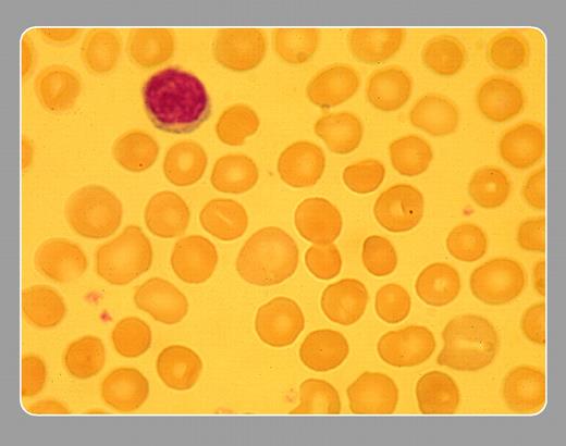 Stanley Schrier, Stanford University School of Medicine