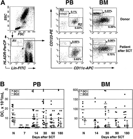 Figure 1. Reconstitution of DC1 and DC2 subpopulations after allogeneic SCT. (A) FACS analysis of DC1 and DC2 in PB and BM samples from a healthy donor and a patient 30 days after SCT (for details, see “Patients, materials, and methods”). Lin–HLA-DR+ cells (gate R1) were further analyzed for the presence of CD11c+CD123low DC1 subset (gate R2) and CD11c–CD123high DC2 subset (gate R3). DC1 and DC2 content is expressed as a percent of total nucleated cells. (B) DC1 (•) and DC2 (○) in PB and BM of individual healthy donors (N) and patients after SCT. Time after transplantation and mean values are indicated. *P < .05, **P < .005 compared with healthy controls.