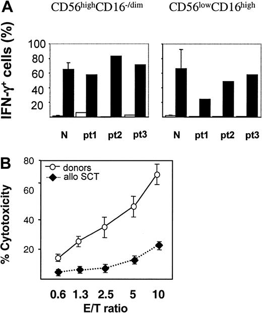 Figure 5. IFN-γ production and cytotoxicity of NK cells from patients after SCT. (A) IFN-γ production by NK-cell subsets. CD16–/low and CD16high cells were purified, expanded, and stimulated with IL-2 (□) or IL-12 plus IL-18 (▪). Frequency of IFN-γ+ NK cells was determined by MACS IFN-γ secretion assay as described in “Patients, materials, and methods.” Results obtained with healthy donors (n = 3) and 3 patients (pt) after SCT are shown. (B) Cytotoxicity of NK cells against K562 target cells. NK cells were purified from PB of healthy donors (○) or patients after allogeneic SCT (♦) collected at 14 and 30 days after SCT. Cytotoxicity was measured as LDH released from lysed K562 cells (“Patients, materials, and methods”). Results obtained with 3 healthy donors and 5 patients after SCT are shown (mean ± SEM).