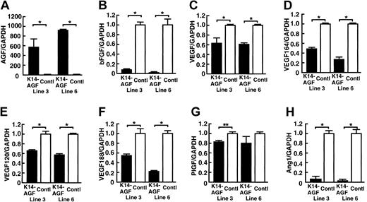 Figure 2. Quantitative RT-PCR analysis of genes encoding angiogenic factor. Comparison of mRNA encoding AGF (A), bFGF (B), VEGF (C), VEGF164 (D), VEGF 120 (E), VEGF 188 (F), placental-derived growth factor (PlGF) (G), and Ang-1 (H) from ear tissues of two 8-week-old K14-AGF transgenic mice (lines 3 and 6; ▪) and their littermate controls (control; □). Columns represent mean values ± SD (n = 3). The relative abundance of transcripts was normalized to the constitutive expression level of GAPDH mRNA. *P < .001; **P < .01, relative to controls.