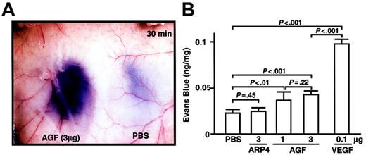 Figure 5. AGF induction of vascular leakage. For a vascular permeability assay, male 8-week-old BALB/c mice were anesthetized, and 100 μL 1% Evans blue dye was injected into the tail vein. At 5 minutes after injection of dye, AGF (1 μg or 3 μg), ARP4 (3 μg), VEGF (0.1 μg), or PBS was injected intradermally at adjacent locations on the back skin. (A) A representative result of dye leakage in the back skin 30 minutes after injection of AGF (3 μg, left) and PBS (right) is shown. Original magnification, × 8.4. (B) Vascular leakage is measured spectrophotometrically by Evans blue content of back skin 30 minutes after intradermal injection. Columns represent mean values ± SD (n = 5).