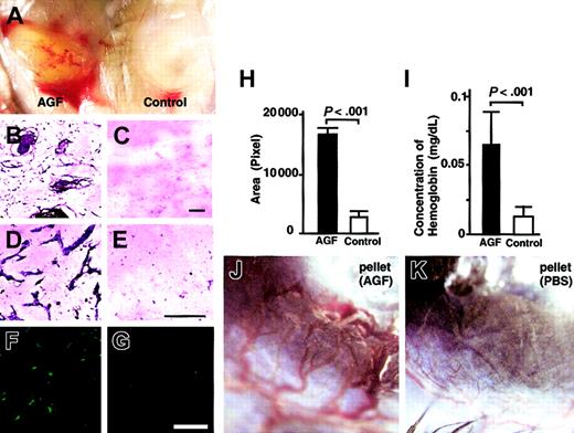 Figure 6. AGF induces in vivo neovascularization. AGF induces angiogenesis in an in vivo Matrigel assay (A-I). (A) Matrigel containing AGF (left) or PBS only (right) was subcutaneously injected near the abdominal midline of 8-week-old C57BL/6 mice. Gross appearance of Matrigels on day 5. (B-G) Histologic analysis of sections from Matrigels. Cells in Matrigels were visualized by staining with May-Giemsa (B-E). Endothelial cells were visualized by staining with anti–PECAM-1 antibody (F-G). Scale bars indicate 100 μm. (H) Black (Matrigel containing AGF) and white (Matrigel only) columns represent the area of vessels, which was measured quantitatively by means of an image analyzer. The data are presented as mean values ± SD (n = 5). (I) Values represent the concentration of hemoglobin per Matrigel plug weight ± SD for 5 assays. (J-K) AGF induces angiogenesis in a corneal neovascularization assay (n = 5). Gross appearance of neovascularization in the cornea. Pellets containing AGF (J) induced neovascularization, while pellets containing control buffer (K) did not.