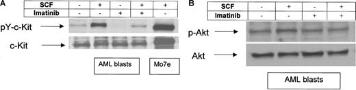 Figure 3. Effects of imatinib on c-kit tyrosine-phosphorylation and SCF-induced phosphorylation of Akt. PB was taken before start with imatinib. MNCs were separated and treated with SCF (100 ng/mL), imatinib (1 μM), and in combination for 15 minutes. As a control, the SCF-dependent leukemic cell line Mo7e was used. Whole cell lysates were prepared and immunoblotted using an antiphosphotyrosine c-kit antibody (A) or an antiphospho-Akt antibody (B). To control equal loading, the blot was stripped and reprobed with anti–c-kit (A) or Akt (B). Shown is a representative result of a total of 5. Arrows indicate the position of the 160-kD isoform of c-kit (A) and of Akt (B), respectively.