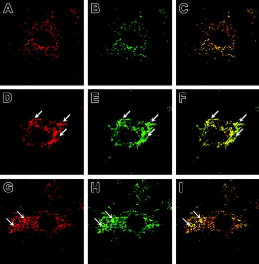 Figure 1. P-selectin and VWF colocalize in rod-shaped WPBs of ECs and cluster to cell membrane on stimulation. HUVECs were stimulated with solution buffer (DPBS), histamine, or VEGF-A165 for 7.5 minutes, fixed, labeled with antisera, and visualized with a Zeiss LSM 510 confocal fluorescent microscope. Shown is the subcellular localization of P-selectin (A,D,G; TRITC staining, colored red), VWF (B,E,H; FITC staining, colored green), and their colocalization in WPBs (C,F,I; colocalized pixels are colored yellow). In DPBS-treated cells, WPBs were distributed homogeneously (A-C), whereas in cells treated with VEGF-A165 (D-F) and histamine (G-I), WPBs clustered along the cell membrane (arrows). For control experiments, HUVECs were prepared according to the labeling procedure except that primary antibodies were omitted (not shown). Original magnification: ×630.