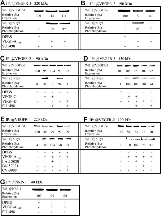 Figure 3. Expression and regulation of VEGFRs in HUVECs. HUVECs were treated either with DPBS or VEGF analogs (10–9 M; 7.5 minutes). Where indicated, HUVECs were pretreated for 15 minutes either with a VEGFR-2 inhibitor or PAFR antagonists prior to stimulation with VEGF analogs. Lysates were prepared and VEGFR-1 (A,E), VEGFR-2 (B,C,F), VEGFR-3 (D), or NRP-1 (G) were immunoprecipitated (IP) from 1 mg lysate. Following resolution on SDS-PAGE and transfer onto polyvinylidene difluoride (PVDF) membranes, immunoreactive bands were visualized by enhanced chemiluminescence (ECL), digitized using a 2-dimensional gel scanner, and quantified using Quantity One software (Bio-Rad). Results were normalized to those from DPBS-treated cells (upper bands). Membranes were subsequently stripped using Re-Blot Plus Strong stripping solution and the detection of VEGFR-1, VEGFR-2, or VEGFR-3 phosphorylation was performed with antiphosphotyrosine antibodies. Phosphorylation results were normalized to those from cells treated with VEGF analogs (lower bands).