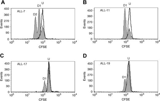 Figure 6. High-resolution cell division tracking of xenografts in vitro. Xenograft cells were retrieved from cryostorage, labeled with CFSE, sorted, and cultured on MS-5 cells. After 3 days, cells were harvested and analyzed (shaded area) in relation to undivided cells equivalent to day 0 (solid line). Peak channels for undivided (U), division 1 (D1), and division 2 (D2) cells were as indicated. A significant proportion of ALL-7 cells (A) had divided twice by day 3, whereas the majority of ALL-11 cells (B) had divided only once. In contrast, only a small proportion of ALL-17 (C) and ALL-19 (D) cells had undergone a single division at this time.