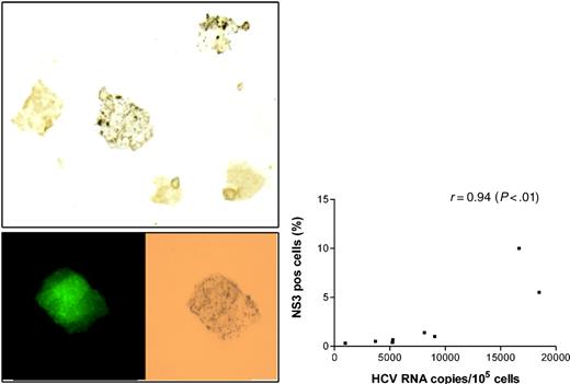 Figure 5. Staining of HIV/HCV-coinfected macrophages for HCV and HIV antigens. (A) Infected macrophages stained with monoclonal antibodies against nonstructural protein 3 (NS3) and visualized with DAB. Two of 5 macrophages shown demonstrate brown granular cytoplasmic staining (original magnification, × 400). Cell shown in the bottom insert is positive for both p24 (left) and NS3 (right). (B) Relationship between HCV RNA cellular load at 2 weeks and the proportion of cells staining for NS3 (r = 0.94; P < .01 by Spearman rank test).