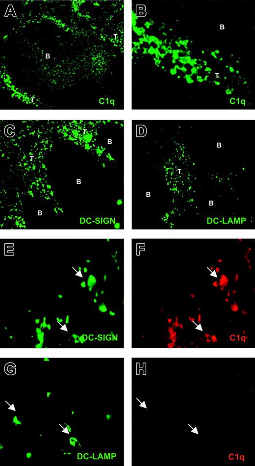 Figure 6. Detection of C1q+ and C1q– DCs in human tonsils. Cryostat tonsil sections were analyzed for DC markers and C1q through single staining. Sections were incubated with rabbit antihuman C1q (A; original magnification, × 100) (B; original magnification, × 400), mouse antihuman DC-SIGN (C; original magnification, × 100), and mouse antihuman DC-LAMP (D; original magnification, × 100), as described in “Materials and methods.” Cryostat tonsil sections were also analyzed through double staining (E-H; original magnifications, × 630). Sections were incubated with mouse antihuman DC-SIGN and rabbit antihuman C1q (E-F, respectively) or mouse antihuman DC-LAMP and rabbit antihuman C1q (G-H, respectively). B indicates B-cell follicle; T, T-cell zone.