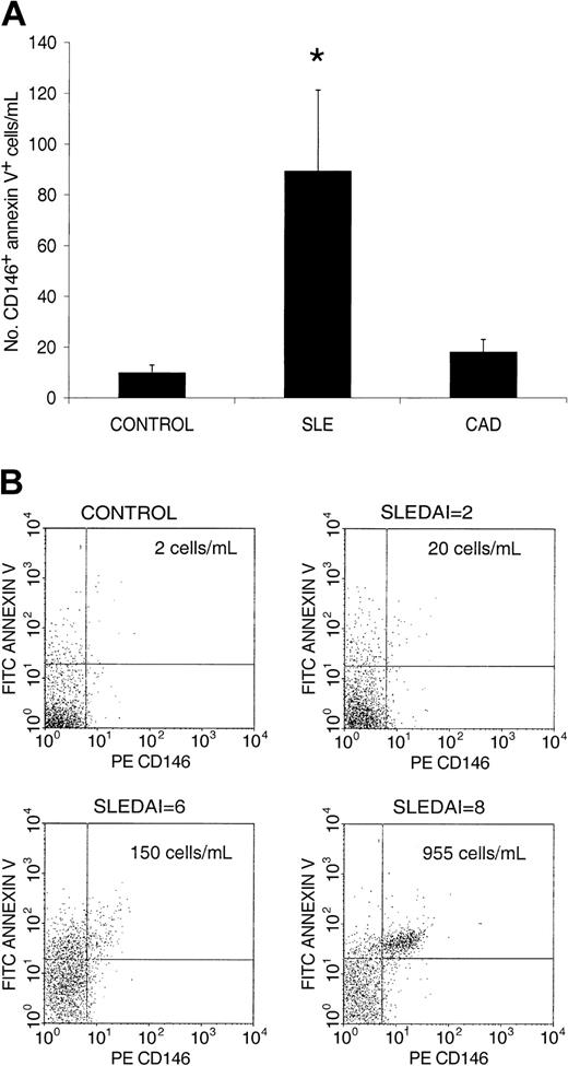 Figure 2. Patients with SLE have increased numbers of circulating apoptotic endothelial cells that correlate with disease activity. (A) Number of circulating CD146+ cells expressing annexin V (CD146AnnV) per volume of blood (milliliter) in healthy control subjects and in patients with SLE and CAD. (*P < .01, results represent mean ± SD). (B) Dot-plots displaying circulating apoptotic ECs in a healthy control subject, and 3 patients with SLE with different degrees of disease activity, as measured by SLEDAI. On the basis of the PBMC counts, we calculated the absolute number of circulating CD146AnnV+ per milliliter, represented in the right upper quadrant.