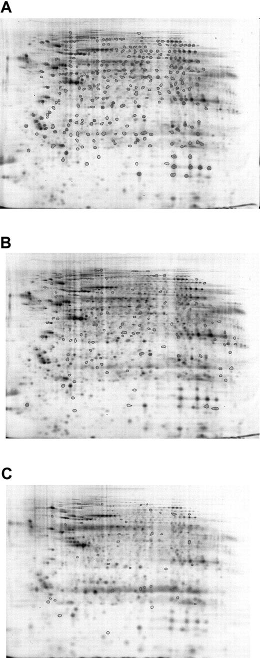 Figure 3. Averaged gel comparison of Lin–Sca+Kit+ and Lin–Sca+Kit– cells labeled with saturation dyes. The use of averaged gels to allow sample comparison for Lin–Sca+Kit+ and Lin–Sca+Kit– cell lysates. Data from 5 sets of reciprocally labeled Lin–Sca+Kit–/+ populations were pooled and significant differences in protein expression (normalized volume) calculated using a 2-tailed Student t test. (A) All protein spots common to both gels are shown with enclosed areas. (B) Representative Lin–Sca+Kit– gels showing spots unique to Lin–Sca+Kit–. (C) Spots unique to Lin–Sca+Kit+.