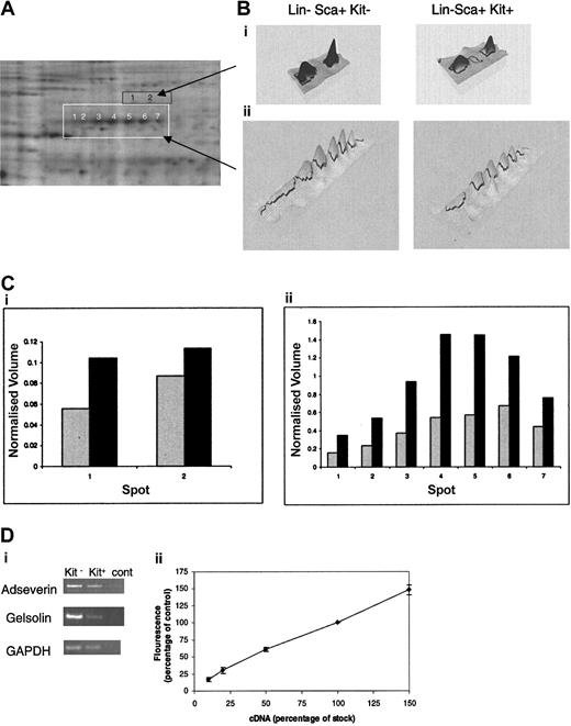 Figure 5. Differential expression of adseverin and gelsolin spots in Lin–Sca+Kit– and Lin–Sca+Kit+ cells from murine bone marrow. (A) Protein spots yielding tryptic mass fingerprints (using MALDI mass spectrometry) characteristic of adseverin and gelsolin are highlighted in white (for adseverin) and orange (for gelsolin). (B) Areas corresponding to the boxed regions in A are shown in 3D pseudocolor format. (C) Histograms of the normalized volumes of the spot chains Lin–Sca+Kit+ (▦) and Lin–Sca+Kit– (▪) (from left to right: 1-7 for adseverin, shown in white; 1 and 2 for gelsolin, shown in black) for gelsolin (i) and adseverin (ii). Normalized volume was calculated on the basis of spots present in all gels. (Di) The relative expression levels of adseverin and gelsolin mRNA in primitive hematopoietic cells were assessed by semiquantitative PCR using GAPDH as a loading control. Transcripts were amplified and visualized by agarose gel electrophoresis. (Dii) Amalgamated results of RT-PCR reactions from a dilution series of 10%, 20%, 50%, and 150% of cDNA for each primer combination. The data illustrate the semiquantitative nature of the RT-PCR. Error bars indicate SEM of 3 observations.