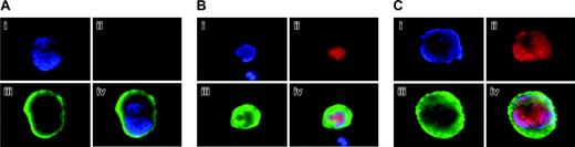 Figure 1. Aurora-B/AIM-1 expression in primary megakaryocytes at interphase. Mouse primary megakaryocytes were stained with DAPI (blue; i), anti–Aurora-B/AIM-1 antibody (red; ii), or FITC-conjugated anti-CD41 (green; iii). Triple staining (iv). Shown are representative images captured as described in “Materials and methods.” (A) Mature megakaryocyte (not cycling) with ploidy of 16N at interphase. (B) Polyploidizing megakaryocyte with ploidy of 8N at interphase/early prophase. (C) Polyploidizing megakaryocyte with ploidy of 32N at interphase/early prophase. Original magnification, × 1500.