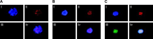 Figure 5. Survivin expression in primary megakaryocytes. Mouse primary megakaryocytes were treated with or without 20 μM proteasome inhibitor MG132 for 6 hours. Cells at prophase were stained with DAPI (blue; i), anti–Aurora-B/AIM-1 antibody (red; ii), or anti-survivin (green; iii). Triple staining (iv). Shown are representative images captured as described in “Materials and methods.” (A) Polyploidizing megakaryocyte with ploidy of 16N at prophase. (B) MG132-treated polyploidizing megakaryocyte with ploidy of 8N at prophase. In approximately 100 megakaryocytes examined (treated or not treated with MG132), survivin was not detected. Similar results were noted for cells at anaphase (not shown). (C) Only one 8N megakaryocyte at prophase displayed survivin after MG132 treatment. Original magnification, × 1500.