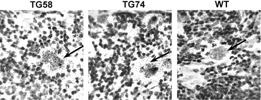 Figure 8. In situ hybridization of Aurora-B/AIM-1 mRNA. In situ hybridization was performed to examine the message level of Aurora-B/AIM-1 in transgenic megakaryocytes. Microscopic images shown here demonstrate that morphologically recognizable large megakaryocytes4 (identified by arrows) in the spleen of transgenic mice (TG 58 or TG 74) have elevated levels of the Aurora-B/AIM-1 message compared with control wild-type (WT) counterparts of similar cell size. Some small-diameter cells showed a strong positive signal in the wild-type or transgenic samples (not shown). Approximately 30 polyploid megakaryocytes of similar diameter were surveyed in each preparation. Original magnification, × 200.