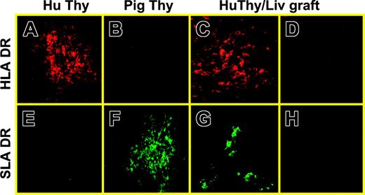 Figure 4. Reconstitution of human thymus grafts with porcine class II+ cells in NOD/SCID-Tg mice given transplants of porcine BMCs plus human Thy/Liv tissues. (A,E) Normal human fetal thymus; (B,F) normal porcine thymus; (C-D,G-H) a human Thy/Liv graft removed at week 20 after implantation from a NOD/SCID-Tg mouse that received porcine BMCs and human Thy/Liv tissues. Panels A-C, HLA DR; E-G, SLA DR; D,H, isotype control. Original magnifications: × 20 (A-B, E-F); × 40 (C-D, G-H).