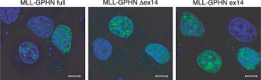 Figure 2. Nuclear localization of MLL-GPHN chimeric protein and its mutants. EGFP-tagged MLL-GPHN and its mutants were transiently transfected in NIH3T3 cells and counterstained with TO-PRO-3. Scale bars indicate 8 μm in length.