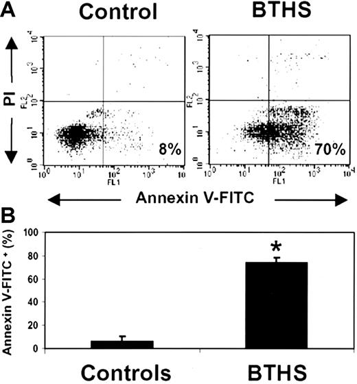 Figure 1. Freshly isolated granulocytes from patients with BTHS display increased annexin-V binding. Freshly purified granulocytes from 7 patients with BTHS and age-matched control individuals (n = 14) were stained by annexin-V–FITC and propidium iodide (PI) and analyzed by flow cytometry. (A) Representative plots for a patient and an age-matched control of the same day; numbers indicate the percentage of annexin-V+ cells among total cell population. (B) Summarized data of all measurements performed. Values represent mean ± SD. *P < .05 by the Student t test.