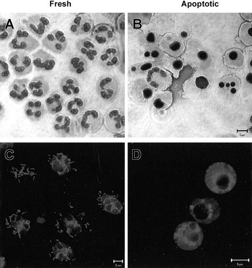 Figure 2. Freshly isolated granulocytes from patients with BTHS display normal morphology and mitochondrial structures. Granulocytes from patients with BTHS were tested for internal signs of apoptosis in a freshly purified preparation (A,C) and upon overnight culture (B,D). (A-B) Neutrophil morphology by light microscopy. (C-D) Mitochondrial staining with MitoTracker GreenFM assessed by confocal laser scanning microscopy. All bars are 5 μm. Results shown are representative of 10 experiments performed on different occasions with cells from 6 patients in total. For comparison with normal neutrophils, see Maianski et al.11