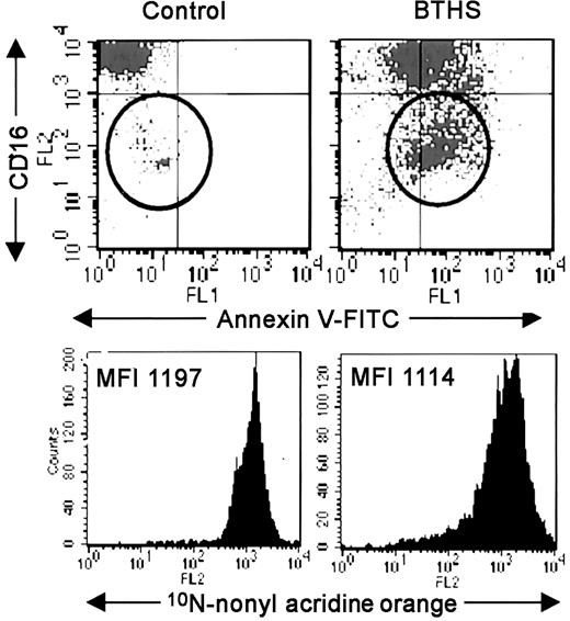 Figure 3. Normal surface expression of CD16 and 10N-nonyl acridine orange (NAO) staining in freshly isolated granulocytes from patients with BHTS. Fresh granulocytes from a control individual (left) and from a BTHS patient (right) were colabeled with annexin-V–FITC and anti-CD16–PE mAb (top; representative for 7 controls and patients tested) or stained with NAO (bottom; representative for 3 controls and patients tested) and analyzed by flow cytometry. In the top panels, CD16–/dull cells (circles) were identified as eosinophils by separate staining with anti-CD9 mAb (a specific eosinophil marker) and morphology of cytospin preparations (data not shown). In the bottom panels, values indicate mean fluorescence intensity (MFI) of NAO staining.