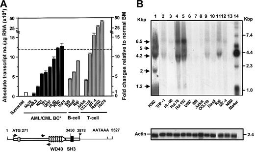 Figure 3. Highly deregulated expression of AHI-1 in human leukemic cell lines. (A) The panel shows absolute AHI-1 transcript levels calculated as described in “Patients, materials, and methods” from real-time RT-PCR analyses of RNA isolated from 16 human leukemic cell lines. Data for total normal human BM cells (data from Figure 2) are shown for comparison. Values shown are the mean ± SEM of data from 3 independent RNA isolates from each cell line. The horizontal dotted line indicates the highest increases in AHI-1 transcript levels found in 5 human cell lines. Below is a schematic diagram of the full-length human AHI-1 isoform I with arrows indicating the position of the specific primers at the 5′ end of the gene used to amplify all transcript isoforms concomitantly (see also Figure 4A). *Stop codons. (B) Detection of different species of AHI-1 transcripts by Northern blot analysis of total RNA from the cell lines analyzed in panel A. Lanes were loaded with 20 μg of total RNA and the blots were probed using a 1.4-kb AHI-1 cDNA fragment.