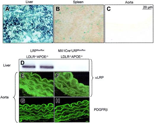 Figure 1. MX1Cre-mediated recombination of the conditional alleles. MX1Cre-mediated recombination was determined 12 weeks after pI:pC induction: (1) by detecting β-galactosidase activity on cryosections of liver (A), spleen (B), and aorta (C) of MX1Cre transgenic mice that had been combined with Cre-reporter mice; (2) by immunoblotting membrane proteins isolated from livers of LRPflox/floxLDLR–/–APOE–/– (D, left 2 lanes) and MX1Cre+LRPflox/floxLDLR–/–APOE–/– (D, right 2 lanes) mice and subsequent staining with a polyclonal rabbit anti-LRP; and (3) by immunofluorescent detection of LRP and PDGF receptor in the descending aorta of LRPflox/floxLDLR–/–APOE–/– (E,G) and MX1Cre+LRPflox/floxLDLR–/–APOE–/– (F,H) mice.