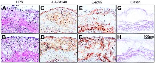 Figure 4. Photomicrographs of representative atherosclerotic lesions. Size-matched lesions of LRPflox/floxLDLR–/–APOE–/– (upper panels) and MX1Cre+LRPflox/floxLDLR–/–APOE–/– (lower panels) mice. Sections were stained with either HPS (A-B), the macrophage-specific antibody AIA-31240 (C-D), the SMC–α-actin–specific antibody (E-F), or with Resorcin-Fuchsin (elastin; G-H).