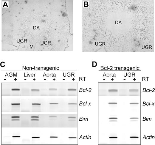 Figure 1. Apoptotic foci and apoptosis-related gene expression in the E11 AGM. TUNEL staining was performed on transverse sections from the truncal region of an E11 embryo to localize apoptotic cells in the AGM region. (A-B) A representative section is shown at 10 × magnification (A) and at 40 × magnification (B). TUNEL+ (black/gray) foci and diffuse scattered individual cells are observed. DA indicates lumen of dorsal aorta; UGR, urogenital ridge; M, mesentery. TUNEL staining was performed 3 times on 2 wild-type and 2 Bcl-2 transgenic embryos. No obvious difference in the TUNEL staining pattern was observed when sections from Bcl-2 transgenic embryos were compared to sections from nontransgenic embryos. (C) Expression of the antiapoptotic genes Bcl-2 and Bcl-x and the proapoptotic Bim gene in the E11 AGM, aorta, UGRs, and liver region of a nontransgenic embryo. RT-PCR analysis was performed on cDNAs made from the indicated midgestation tissues. Signal intensity from the actin PCR fragment was used as a normalization control. Note that, as expected, the Bim primers amplify 2 different transcript isoforms (splice variants). (D) RT-PCR analysis of a Bcl-2 transgenic embryo reveals altered levels of Bcl-2, Bcl-x, and Bim gene expression in the E11 aorta and UGR. RT-PCR analysis was performed 3 times and confirmed on 3 independent sets of cDNAs.