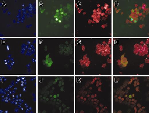 Figure 2. Expression of Bcl-2 by Sca-1+ AGM cells. Immunostaining was performed on Ly-6A (Sca-1) GFP transgenic E12 AGM and E11 aortic cells. AGM and aorta cells were isolated as a single-cell suspension and deposited on microscope slides by cytospin (original magnification, × 100). Panels A, E, and I show 4′,6-diamidino-2-phenylindole (DAPI) staining; panels B, F, and J show Ly-6A (Sca-1) GFP fluorescence; panel C shows anti-Bcl-2 Texas Red fluorescence; and panel G shows anti-Bcl-2 Cy3 fluorescence. Panel K was incubated with no primary antibody. Panels D, H, and L are an overlay of GFP and Texas Red/Cy3 fluorescence. Panels A-D are a cytospin of E12 AGM cells stained with anti-Bcl-2 antibody conjugated with Texas Red. Panels E-H show a cytospin of E11 aorta cells stained with anti-Bcl-2 antibody conjugated with Cy3. Panels I-L show a cytospin of E11 AGM cells incubated with no primary antibody.