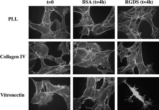 Figure 2. HUVEC spreading on matrix glycoproteins. Cell morphology on coverslips coated with PLL, vitronectin, or collagen IV (50 μg/mL) was examined. Cells were treated for 4 hours with RGDS (500 μg/mL) and stained with FITC-conjugated phalloidin (original magnification, × 40). In all cases cells showed a similar spreading and actin stress fibers morphology, indicating that while RGDS had no antiadhesive effect on collagen IV and poly-L-lysine, it had an antiadhesive effect on vitronectin, as expected. Experiments were carried out in triplicate. The images shown refer to a representative experiment.