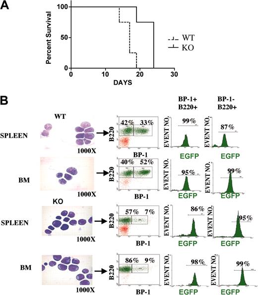 Figure 2. Delayed onset but similar phenotype of leukemic disease in mice that received transplants of p190-BCR-ABL-transduced fetal liver from Pik3r1 null embryos. Wild-type and Pik3r1 null fetal liver transduced with p190-BCR-ABL were allowed to expand one week in vitro prior to transplantation of 1 × 106 cells into SCID mice. (A) Kaplan-Meyer plot showing number of days until leukemia development. Of the mice, 4 received wild-type cells (from 2 pooled embryos) and 4 received Pik3r1 null cells (from one embryo). (B) Bone marrow and spleen cells were cytospun and stained with Giemsa/Wright to show the lymphoblastic phenotype. Cells were also analyzed by FACS for expression of GFP, B220, and BP-1. Original magnifications of the panels are shown below the images.
