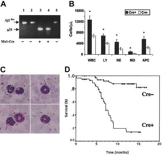 Figure 1. Blood leukocyte values and survival in Mx1-Cre, Nf1 flox/flox and Nf1 flox/flox mice. (A) PCR analysis of leukocyte DNA from 6-week-old pups that received a single injection of pI-pC shortly after birth. PCR amplification of the unrearranged Nf1flox allele yields a 350-bp product. A 280-bp fragment corresponding to a deletion of exon 31 (Δ31) is visible in 2 pups that inherited the Mx1-Cre transgene (+) but not in 3 pups that did not (-). Absence of the unrearranged allele in lanes 3 and 4 confirms a high efficiency of somatic recombination. (B) White blood cell counts (WBCs) in 3-month-old pI-pC-treated Mx1-Cre, Nf1flox/flox (Cre+)(n = 21) and control Nf1flox/flox littermates that did not inherit the Mx1-Cre transgene (Cre-) (n = 18). The abbreviations are LY, lymphocytes; NE, neutrophils; MO, monocytes; APC, absolute phagocyte count (neutrophils + monocytes). Leukocyte counts are expressed as ± SEM. Asterisks indicate significant differences (P < .05 by Student t test) between the Cre+ and Cre- animals. (C) A composite photomicrograph (original magnification × 400) of peripheral blood from a Cre+ mouse shows mature neutrophils (top left), intermediate forms (top right), a monocyte and a mature neutrophil (bottom left), and an intermediate form, which is likely in the monocytic lineage (bottom right). (D) Kaplan-Meier analysis demonstrates a significant reduction in survival in Cre+ (n = 59) versus Cre- (n = 72) littermates (P < .0001).