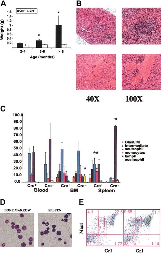 Figure 2. Pathologic analysis of tissues from Mx1-Cre, Nf1 flox/flox mice. (A) Cre+ mice demonstrate progressive splenomegaly. Data are presented as the mean ± SEM. (A,C) Asterisks indicate significant differences (P < .05) between the Cre+ and Cre- animals. (B) Spleen (top) sections from Cre+ mice demonstrate expansion of the red pulp with myeloid infiltration. Liver sections (bottom) show periportal infiltration. (C) Manual differential counts of the percentage of nonerythroid cells in blood, bone marrow (BM), and spleen from Cre+ and Cre- mice. Note that the bone marrow myeloid cells show a normal pattern of differentiation and that the spleen shows a massive increase in myelopoiesis. The data are shown as the mean ± SD. (D) Cytospins of bone marrow and spleen in a Cre+ mouse with MPD show maturing neutrophilic and monocytic elements (original magnification × 200). (E) Representative FACS data from Cre- (left) and Cre+ (right) bone marrows. Cre+ mice with MPD demonstrate an increased percentage of Gr1+/Mac1+ cells (51% versus 22%). There is marked expansion in the Mac-1+/Gr-1lo subset (11.5% in Cre+ versus 2.13% in Cre- mice), which is consistent with an increase in monocytic cells. The numbers shown indicate the percentage of cells within each quadrant.