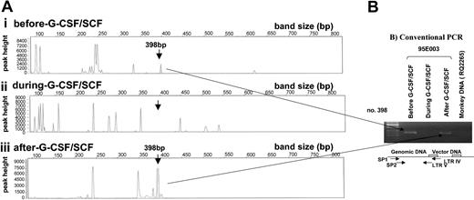 Figure 5. Tracking of individual clones by way of LAM-PCR and conventional PCR. (A) Gene Scan results of LAM-PCR. DNA (100 ng) isolated from 95E003 granulocytes before, during, and after G-CSF plus SCF treatment show the presence and the absence of clone no. 398. (B) Conventional PCR for clone no. 398 using clone-specific primers. DNA (100 ng) was used for nested PCR analysis using no. 398 specific primers (SP1, SP2) with an LTR primer. Note the presence of no. 398 clone before and after cytokine treatment. DNA from an animal (RQ2265) that received transduced cells with the same vector was used as a negative control.