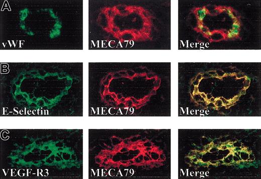 Figure 4. Expression of VWF, E-selectin, and VEGFR-3 in HEV in vivo. Double immunofluorescence staining of human tonsil sections with MECA-79 (red) and anti-VWF (A), anti–E-selectin (B), or anti–VEGFR-3 (C) antibodies (green) reveals expression of these markers in MECA-79–positive HEV in situ (original magnification, × 100).