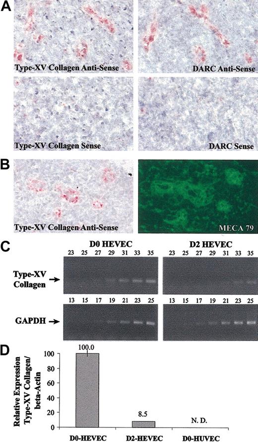 Figure 5. Expression of type XV collagen in HEVs in vivo and its rapid down-regulation in cultured HEVECs. (A) In situ hybridization analysis (original magnification, × 40) of type XV collagen mRNA in human tonsils reveals an expression pattern similar to that of DARC. Cryosections were hybridized with type XV collagen or DARC sense and antisense riboprobes. (B) In situ hybridization (original magnification, × 40) with type XV collagen antisense riboprobe (left) followed by immunostaining with the HEV-specific mAb MECA-79 (right) demonstrates expression of type XV collagen mRNA in MECA-79–positive HEVs. (C) Semiquantitative RT-PCR analysis of type XV collagen down-regulation in cultured HEVECs after 48 hours ex vivo (D2 HEVECs) compared with freshly isolated HEVECs (D0 HEVECs). Amplification of GAPDH mRNA was used as an internal control. (D) Comparison of type XV collagen mRNA levels in D0 HEVECs, D2 HEVECs, and D0-HUVECs by real-time quantitative RT-PCR. β-actin mRNA was used as a standard. Standard deviations are shown; N.D. indicates not detected.