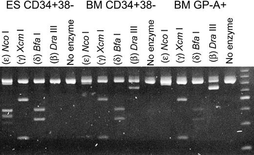 Figure 3. Semiquantitative expression analysis of the ϵ-, γ-, δ-, and β-globin genes. For the RT-PCR, a single set of primers was used. The products were then digested with restriction enzymes specific for each specific globin gene. The individual enzymes are indicated at the top of each lane.