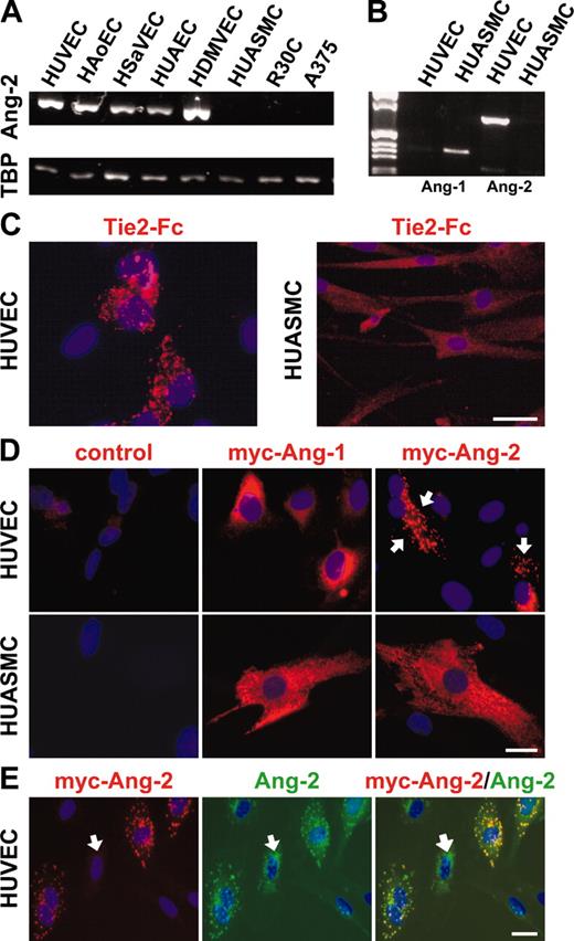Figure 1. Distinct granular expression of Ang-2 in endothelial cells. (A) RT-PCR analysis identifying Ang-2 expression in HUVECs, HAoECs, HSaVECs, HUAECs, and HDMVECs, but not in HUASMCs and the mammary and melanoma tumor cell lines R30C and A375 (TBP, control RT-PCR for the TATA box-binding protein). (B) RT-PCR analysis of endothelial cell and smooth muscle cell Ang-1 and Ang-2 production identified endothelial cells as a source of Ang-2 and smooth muscle cells a as source of Ang-1 (lanes 2 and 3 are Ang-1 RT-PCRs; lanes 4 and 5 are Ang-2 RT-PCRs). (C) Soluble Tie-2-Fc receptor bodies identify both Ang-1 and Ang-2. Tie-2-Fc stains permeabilized endothelial cells in a distinct granular manner and permeabilized smooth muscle cells with a uniform cytoplasmic pattern. (D) Retrovirally overexpressed Ang-2 is localized in endothelial cells in a characteristic granular pattern (arrows) and in smooth muscle cells with a uniform cytoplasmic distribution. In contrast, Ang-1 displays a uniform cytoplasmic distribution pattern in endothelial cells and smooth muscle cells. (E) Colocalization of endogenous and retrovirally overexpressed Ang-2. Nontransfected cells only express endogenous Ang-2 (arrows). Scale bar = 20 μm (C-E)