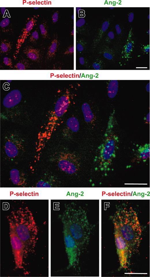Figure 3. Exclusion of Ang-2 and P-selectin storage in endothelial cell Weibel-Palade bodies. P-selectin (A) and Ang-2 (B) are both expressed in a distinct granular pattern in endothelial cells. Yet, their expression does not overlap (C). (D-F) Granular storage of P-selectin and Ang-2 is not just mutually exclusive in different cells, but also in Weibel-Palade bodies of the same cell (panel D, P-selectin; panel E, Ang-2; and panel F, double staining of P-selectin and Ang-2 with nonoverlapping expression in red and green granules). Scale bar is 20 μm.