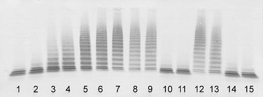 Figure 1. Determination of ADAMTS13 activity by immunoblotting of VWF substrate degraded by BaCl2-activated ADAMTS13 in patient plasma (diluted 1:20). Lanes 1-7: assay calibration by normal plasma dilutions of 1:20 (100% activity), 1:40 (50%), 1:80 (25%), 1:160 (12.5%), 1:320 (6.25%), 1:640 (3%), and buffer control (0%). Sister 1: acute initial TTP episode (lane 8); clinical remission 17, 35, and 37 months after the initial episode (lanes 9-11). Sister 2: acute initial TTP episode (lane 12); clinical remission 5, 23, and 25 months after the initial episode (lanes 13-15).