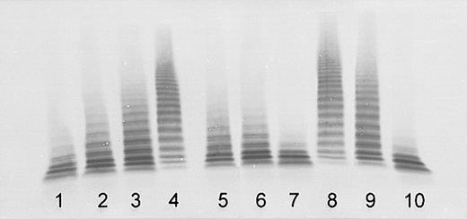 Figure 2. Detection of ADAMTS13 inhibitory autoantibodies by immunoblotting of VWF substrate degraded by BaCl2-activated ADAMTS13 in mixtures of normal human plasma (NHP) with patient plasma obtained at acute initial TTP, or IgG purified from patient plasma (final NHP dilution, 1:20). Lanes 1-4: assay calibration by NHP dilutions of 1:20 (100% activity), 1:40 (50%, equivalent to an inhibitor titer of 1 BU/mL), 1:80 (25%), and buffer control (0%). Sister 1: mixtures of NHP 1:1 (vol/vol) with patient plasma (lane 5), with IgG purified from patient plasma (lane 6), and with IgG-depleted patient plasma (lane 7). Sister 2: mixtures of NHP 1:1 (vol/vol) with patient plasma (lane 8), with IgG purified from patient plasma (lane 9), and with IgG-depleted patient plasma (lane 10).