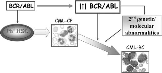 Figure 1. Possible mechanisms of CML disease progression. BCR/ABL expression is sufficient to transform hematopoietic stem/progenitor cells and to induce a CML-like disorder in mice. Increased expression of BCR/ABL, frequently observed in patients with CML-BC, might promote secondary molecular and genetic abnormalities that contribute to the expansion of a cell population characterized by enhanced proliferation, increased resistance to apoptosis, and differentiation arrest.