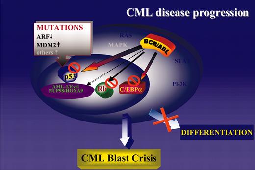 Figure 4. A unifying model of CML disease progression. Genetic or functional inactivation of tumor suppressor genes (p53 and Rb) is the most common abnormality in CML-BC. Loss of C/EBPα expression is also common and promotes differentiation arrest and proliferative advantage due to inhibition of cell proliferation by wild-type C/EBPα.170