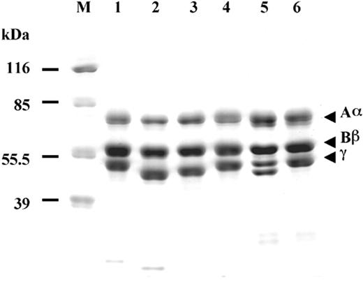 Figure 1. Characterization of recombinant fibrinogens. Coomassie-stained 10% SDS-PAGE run under reducing conditions; normal recombinant fibrinogen (lane 1), γN308K fibrinogen (lane 2), γN308I fibrinogen (lane 3), γN308A fibrinogen (lane 4), plasma fibrinogen from Matsumoto II patient (lane 5), and plasma fibrinogen from normal individual (lane 6). Positions of the molecular markers are indicated on the left (M).