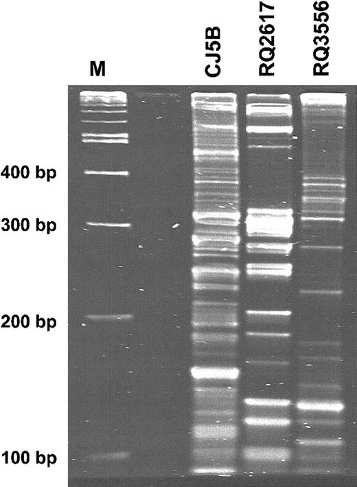Figure 7. Clonal heterogeneity in peripheral blood following reconstitution with autologous, transduced CD34+ cells. Granulocyte DNA was subjected to LAM-PCR, and the products were resolved on a Spreadex gel. Peripheral blood samples were obtained at 7.5 months after reconstitution from animal CJ5B, at 6.5 months from animal RQ2617, and at 5 months from animal RQ3556.