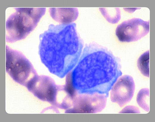 Peter Maslak and Susan McKenzie, Memorial Sloan-Kettering Cancer Center