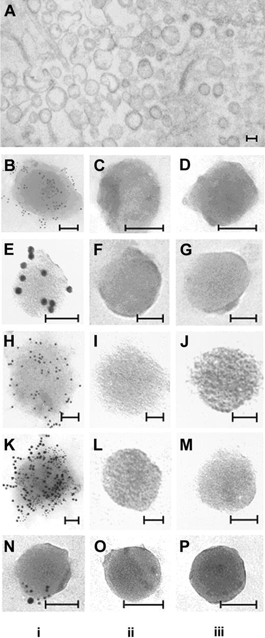 Figure 6. Ultrastructure and immunogold labeling of MPs. Preparation of samples for electron microscopy is described in “Materials and methods.” MPs were isolated from PFP of a volunteer receiving endotoxin. In vivo-generated MPs are seen as vesicular structures with diameters ranging from 0.1 μm to 0.5 μm (A). MPs obtained by ultracentrifugation were incubated with rabbit polyclonal anti-TF antibody and/or anti-CD14 antibody or 1B10 anibody with appropriate secondary gold-labeled antibodies. In column i, positive gold-labeling to TF is demonstrated (B; 6 nm gold), CD14 (E; 12 nm gold), 1B10 (H; 12 nm gold). Microparticles double-labeled for 1B10 and TF (K), and CD14 and TF (N) are also shown. No labeling was observed with control antibodies (column ii) or secondary gold particle-labeled antibodies alone (column iii). Bars = 100 nm.
