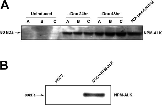 Figure 1. Expression of NPM-ALK in inducible and constitutive Ba/F3 expression systems. (A) Expression of the fusion protein NPM-ALK (80 kDa) in TonBaF.1-NPMALK cells 24 hours and 48 hours after the addition of 2 μg/mL doxycycline. Lanes A, B, and C correspond to 3 independent retroviral transductions of TonBaF.1 cells with pRev-TRE-Hyg-NPM-ALK. Uninduced samples were harvested from cells starved of IL-3 for 17 hours. +Dox 24-hour and +Dox 48-hour samples were harvested from cells starved of IL-3 for 17 hours and induced with 2 μg/mL doxycycline for 24 hours and 48 hours, respectively. Whole-cell lysates were fractionated by SDS-PAGE and immunoblotted with NPM-ALK specific antibody. Cells derived from transduction C were used for subsequent analyses.(B) Expression of the fusion protein NPM-ALK in Ba/F3 cells stably transformed with NPM-ALK. Whole-cell lysates of MSCV and MSCV-NPM-ALK-transduced Ba/F3 cells were harvested, fractionated by SDS-PAGE, and immunoblotted with NPM-ALK-specific antibody.